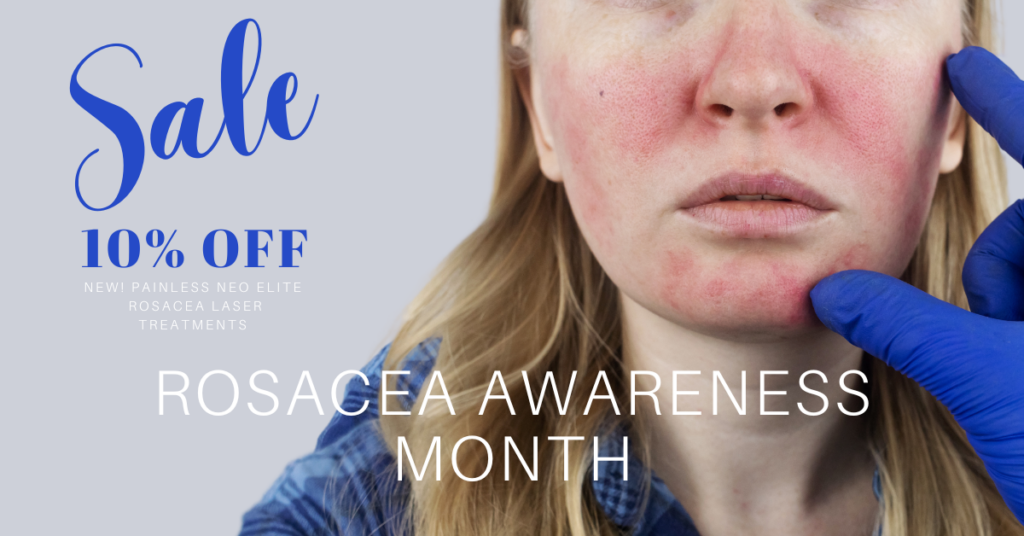 female face with rosacea